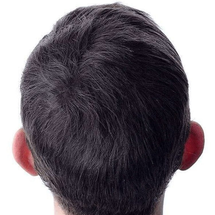 After using Misal Premium Hair Oil (200ml)