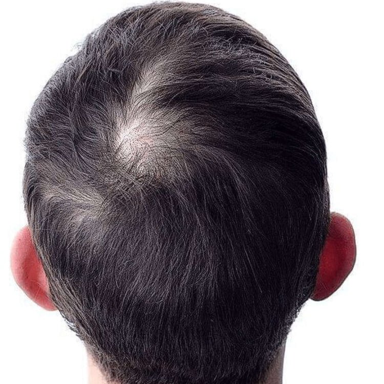 Before using Misal Premium Hair Oil (200ml)